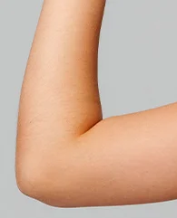 Arms and legs hair removal
